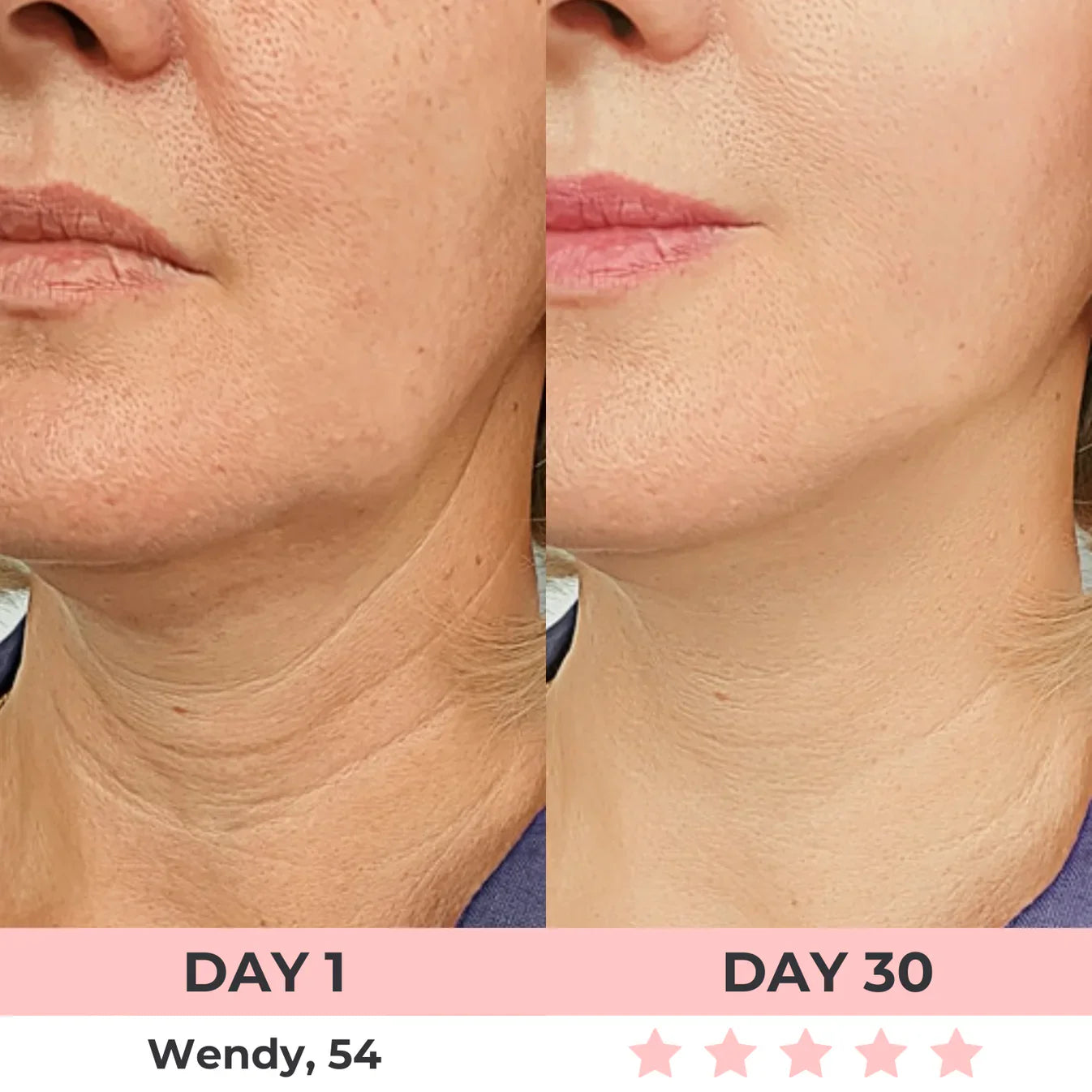 7-in-1 LED Facial Sculptor